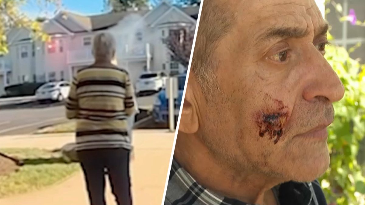 Pet feud between Long Island seniors escalates in chilling flare gun assault - NBC New York